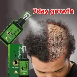 Spray de Crescimento Rápido de Cabelo com Gengibre – Fortalecimento da Raiz, Combate à Queda e Regeneração Capilar – Sérum Nutritivo e Reparador para Couro Cabeludo Danificado (Para Mulheres e Homens)